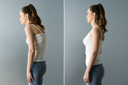 Back Pain Abdominal Posture Before And After