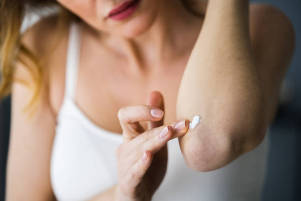 istock Applying Cream On Healthy Dry Skin 1322057190