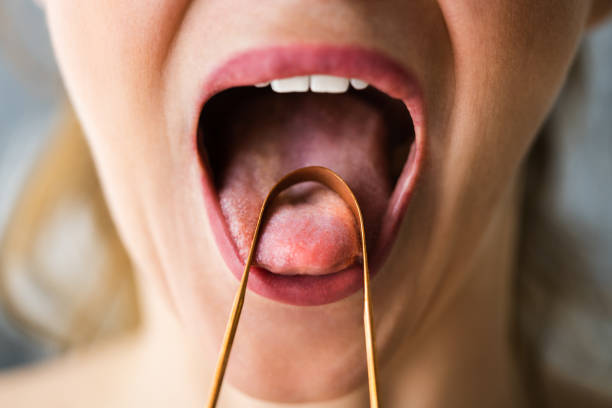 istock Bad Breath Tongue Scraper 1322057199