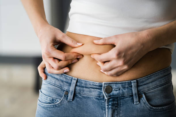 istock Stomach Fat Liposuction And Diet 1322057225