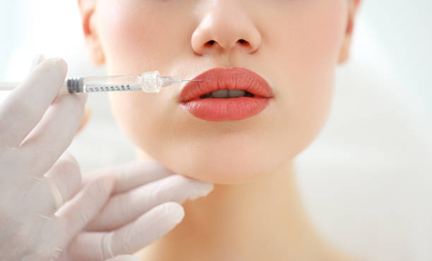 Woman receiving beauty injection in lips Closeup of crop anonymous female patient getting filler injection in lips in cosmetology clinic fillers stock pictures, royalty-free photos & images