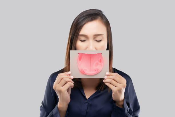 Tongue problems The woman show the picture of tongue problems, Illustration benign migratory glossitis on a brown paper, Behcet's Disease mouth ulcers stock pictures, royalty-free photos & images