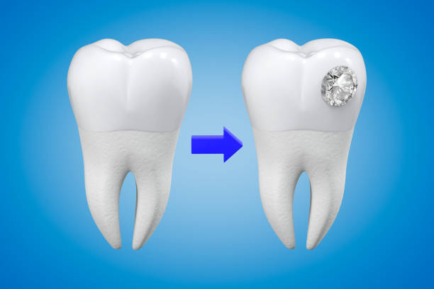 istock An exaggerated example of a diamond tooth decoration procedure. Aesthetic dentistry. 3d rendering. 1322279435
