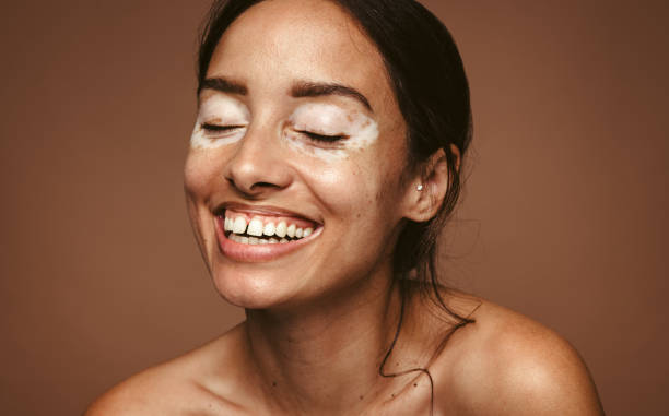 istock Smiling is the best way to embrace your flaws 1322494158