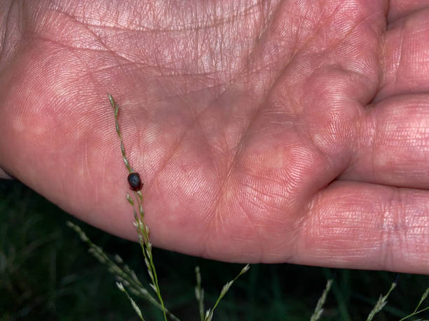 istock Tick stuck on a grass leaf in a caucasian man's hand 1322500365