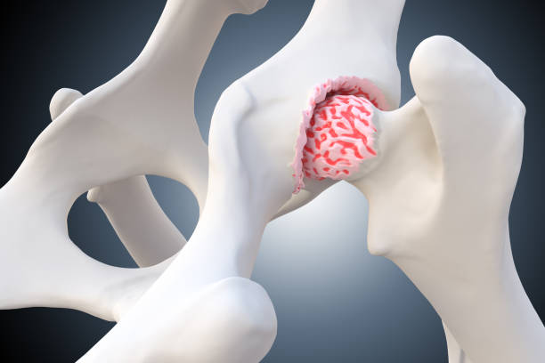 istock Canine Arthritis and Osteoarthritis joint inflammation 1322508513