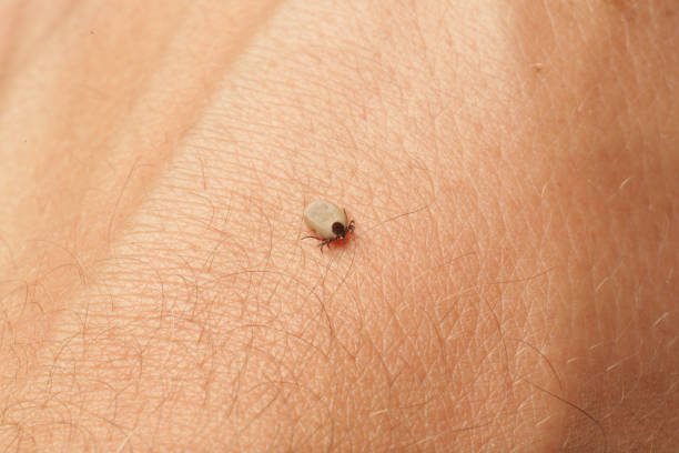 istock Tick on human skin, close up 1322521183