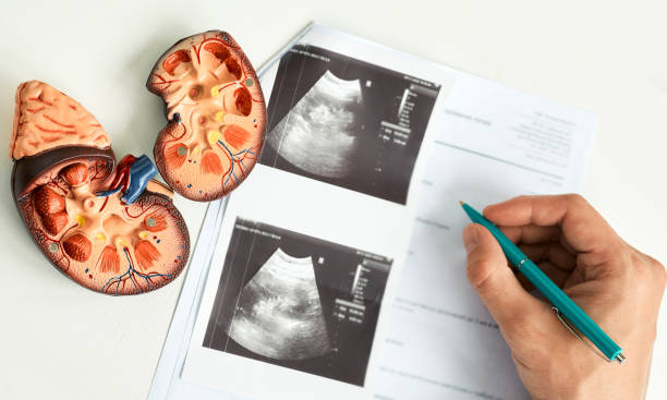 kidney ultrasound. doctor analyzing of patient kidney health using kidney ultrasound - kidney cancer imagens e fotografias de stock