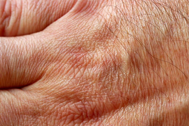 close-up hand of a person close-up hand of a person atrophy stock pictures, royalty-free photos & images