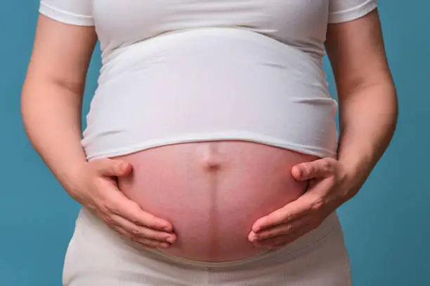 Photo of Dark stripe on the belly of a pregnant woman, studio shot on a blue background