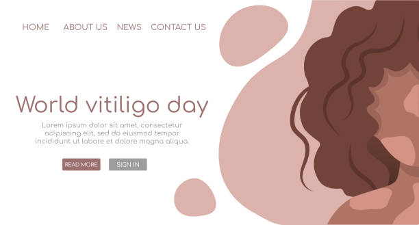 Web template with African woman with curly hair and dark skin with vitiligo.  Body positive concept. World vitiligo day June 25. Vector flat isolated illustration. Web template with African woman with curly hair and dark skin with vitiligo.  Body positive concept. World vitiligo day June 25. Vector flat isolated illustration. vitiligo stock illustrations
