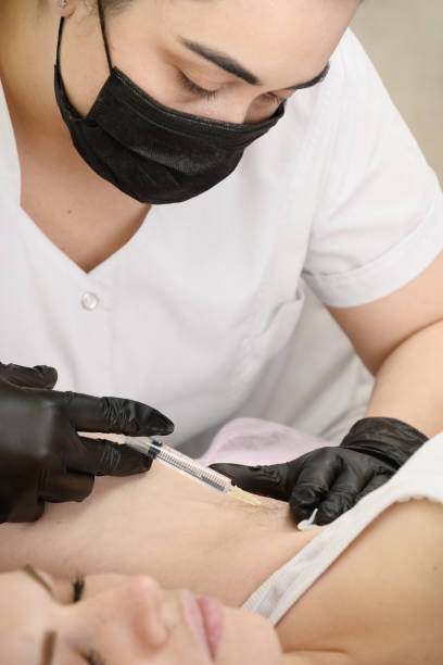 el médico administra una inyección de anestesia en la axila antes del procedimiento de electrólisis - electrologist fotografías e imágenes de stock