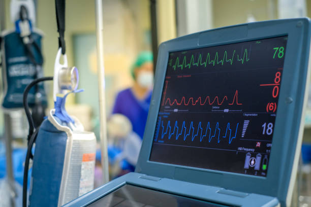 ekg-monitor in intraaorten ballonpumpenmaschine. medizinische geräte. - human heart surveillance computer monitor pulse trace stock-fotos und bilder