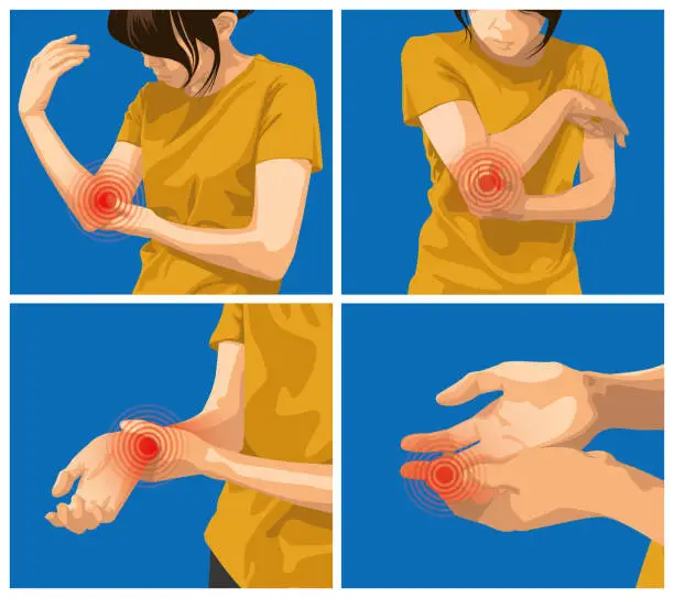 Vector illustration of Pain and injuries in body parts. woman is feeling pain in elbow, wrist and finger.