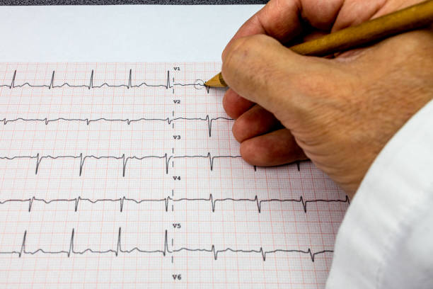 médecin qui analyse un plomb ecg 12 et marque les ondes p présentes dans la trace avec un crayon - pulse trace human cardiovascular system heart shape heart disease photos et images de collection