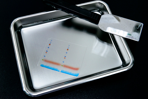 Polyacrylamide gel including separated protein ladder markers and protein samples on the stainless steel tray