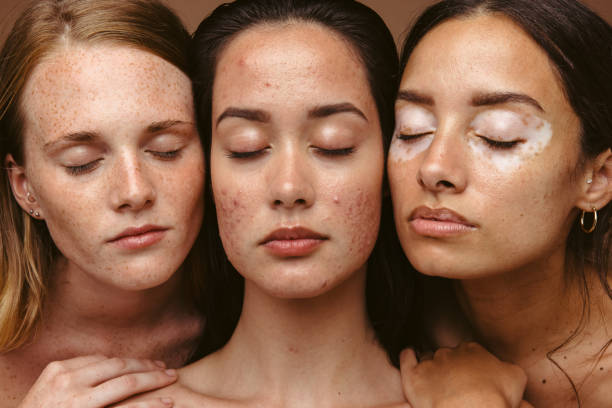 istock Woman with unique skin 1323325405