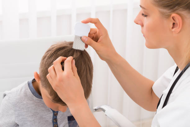 médico fazendo tratamento no cabelo do menino - nits - fotografias e filmes do acervo