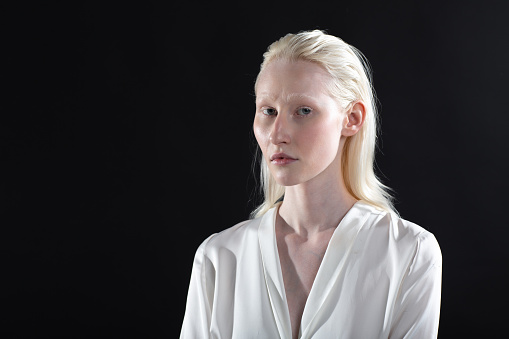 Close up portrait of caucasian albino blonde woman.