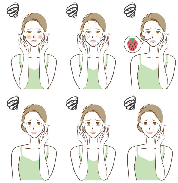 여성의 피부 문제 문제 일러스트레이션 세트 - hand on chin illustrations stock illustrations