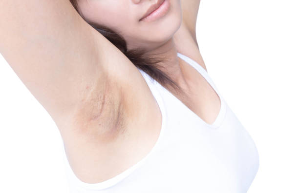 istock Women problem black armpit on white background for skin care and beauty concept 1323630728