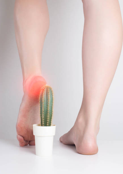 la niña pisa el cactus con el pie. el concepto de dolor en la planta del pie y el talón, trastornos metabólicos, gota - cactus spine fotografías e imágenes de stock
