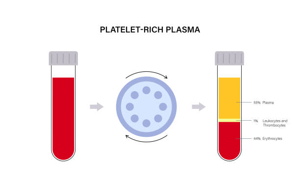 Platelet rich plasma concept Separation of erythrocytes, red blood cells by centrifugation. PRP therapy concept. Platelet rich plasma treatment. Human blood structure and prp injections. Microbiology test flat vector illustration human centrifuge stock illustrations