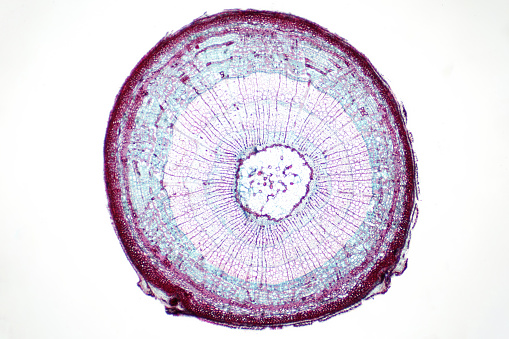Cross sections of plant stem under light microscope view for botany education.