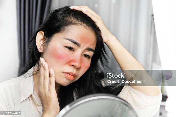 Asian Woman Having Problem With Sunburn On Face Checking Her Redness Skin On A Mirror Stock Photo - Download Image Now
