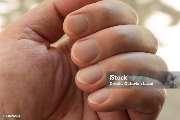 Unkempt Overgrown Caucasian Male Finger Nails Macro Close Up Shot Shallow Depth Of Field Stock Photo - Download Image Now