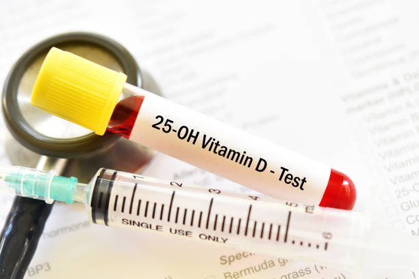 Mẫu máu để xét nghiệm 25-OH vitamin D hoặc vitamin D2/D3 bức ảnh sẵn có