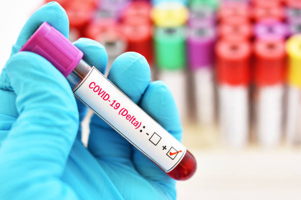 Blood sample positive with delta variant COVID-19 virus Delta variant COVID-19 positive, blood sample tube positive with delta variant or Indian strain COVID-19 pcr device photos stock pictures, royalty-free photos & images
