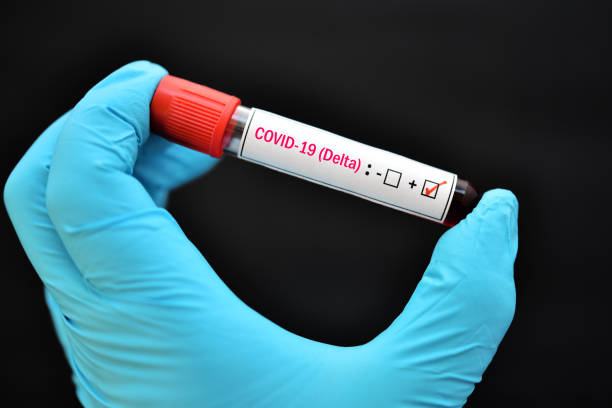 Blood sample positive with delta variant COVID-19 virus Delta variant COVID-19 positive, blood sample tube positive with delta variant or Indian strain COVID-19 real time stock pictures, royalty-free photos & images