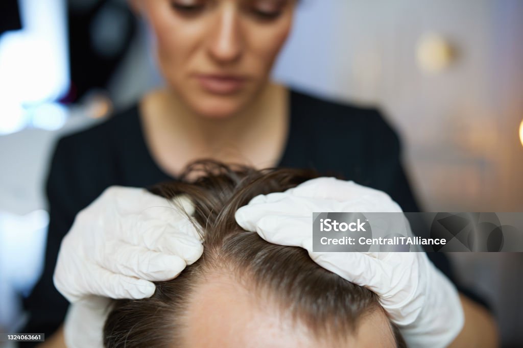 Woman trichologist in rubber gloves checking adult man hair Closeup on woman trichologist in rubber gloves checking adult man hair. Human Scalp Stock Photo