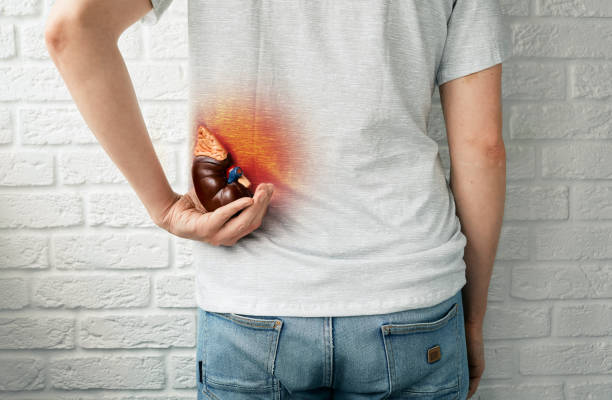 Male suffering from pain with inflammation and renal colic. Kidney diseases in men. Back view Male suffering from pain with inflammation and renal colic. Kidney diseases in men. Back view human kidney stock pictures, royalty-free photos & images