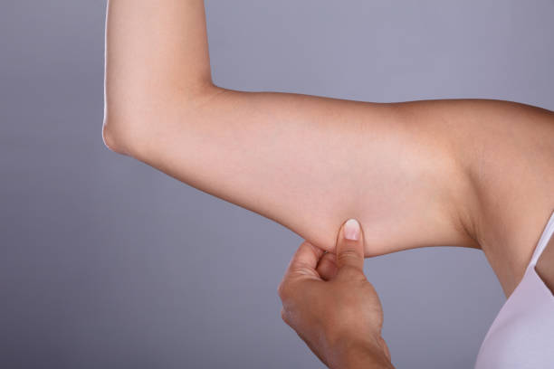 istock Woman Holding Arm With Excess Fat 1324145551