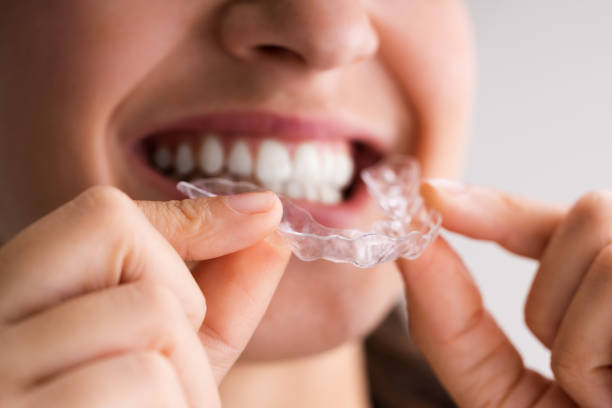 istock Clear Aligner Dental Night Guard 1324146190