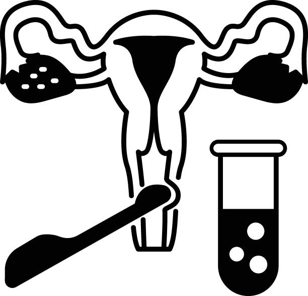 ilustrações, clipart, desenhos animados e ícones de conceito de recuperação de oócito transvaginal, projeto de ícone vetorial de ivf tvor, símbolo de fertilização in vitro no fundo branco, gravidez e signo obstetra, - retrieval