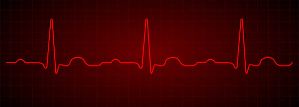 istock Heartbeat line. Red electrocardiogram. Vector pulse line. Medical cardiogram on grid background. 1324220387