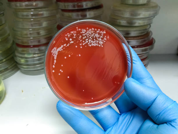 streptococcus bakterienkolonien mit beta-hämolytik um blut-agar-platte, medizinischer hintergrund - blood agar stock-fotos und bilder