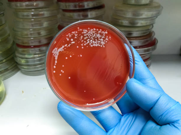 colonias bacterianas del estreptococo con hemolítico beta en la placa del agar de la sangre, fondo médico - staphylococcus petri dish bacterium biology fotografías e imágenes de stock