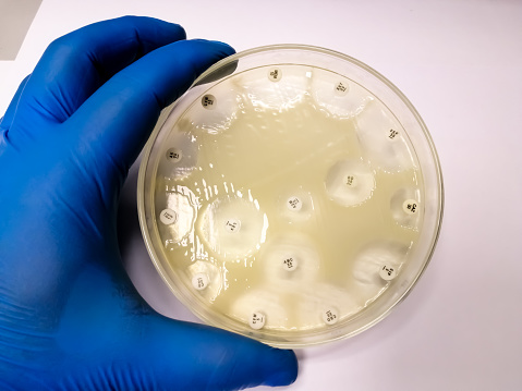 Antimicrobial susceptibility testing in petri dish against Klebsiella pneumoniae (K. pneumoniae) bacteria at microbiology laboratory.