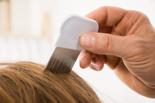 istock Person Using Lice Comb On Patient's Hair 1324370882