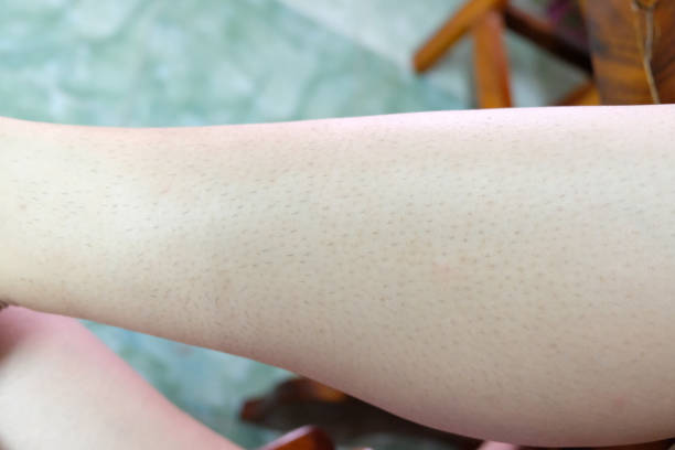 A woman's leg hair is emerging after shaving.