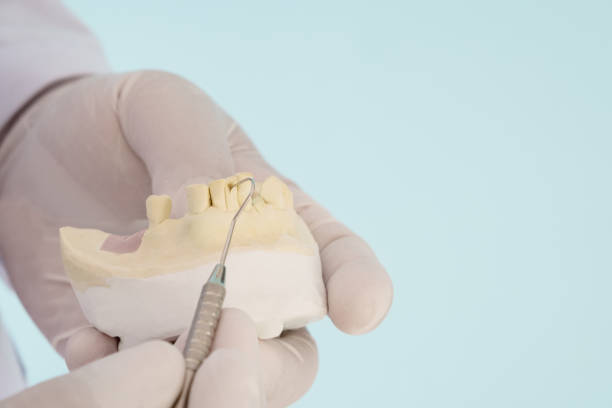 istock Prosthodontics or Prosthetic 1324666139