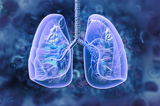 cáncer de pulmón. enfermedad pulmonar. Ilustración 3D photo