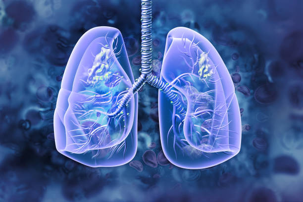 폐암. 폐 질환. 3d 일러스트레이션 - human lung asthmatic x ray human internal organ 뉴스 사진 이미지