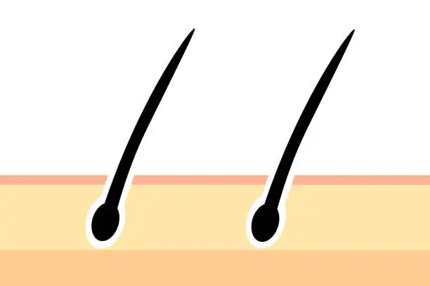 Vector illustration of Illustration of hair follicles