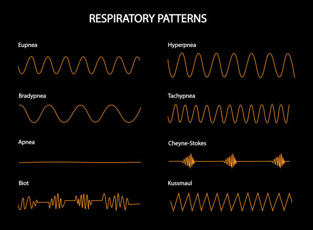 呼吸のパターン。異なる状況の呼吸曲線。ユープネア、高呼吸、徐呼吸、タチプネア、アプネア、シェインストロークス、ビオ、クスマウル。 - ビオ点のイラスト素材／クリップアート素材／マンガ素材／アイコン素材