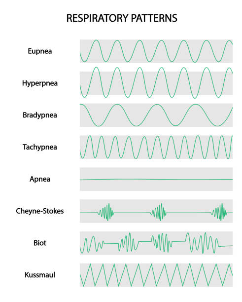 Respiratoy Patterns. Respiratory curves of different situations. Eupnea, hyperpnea, Bradypnea, Tachypnea, Apnea, Cheyne-Strokes, Biot, Kussmaul. Respiratoy Patterns. Respiratory curves of different situations. Eupnea, hyperpnea, Bradypnea, Tachypnea, Apnea, Cheyne-Strokes, Biot, Kussmaul. biot stock illustrations